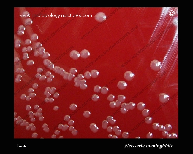 Neisseria meningitidis colonies on blood agar neisseria meningitidis colony morphology on blood agar